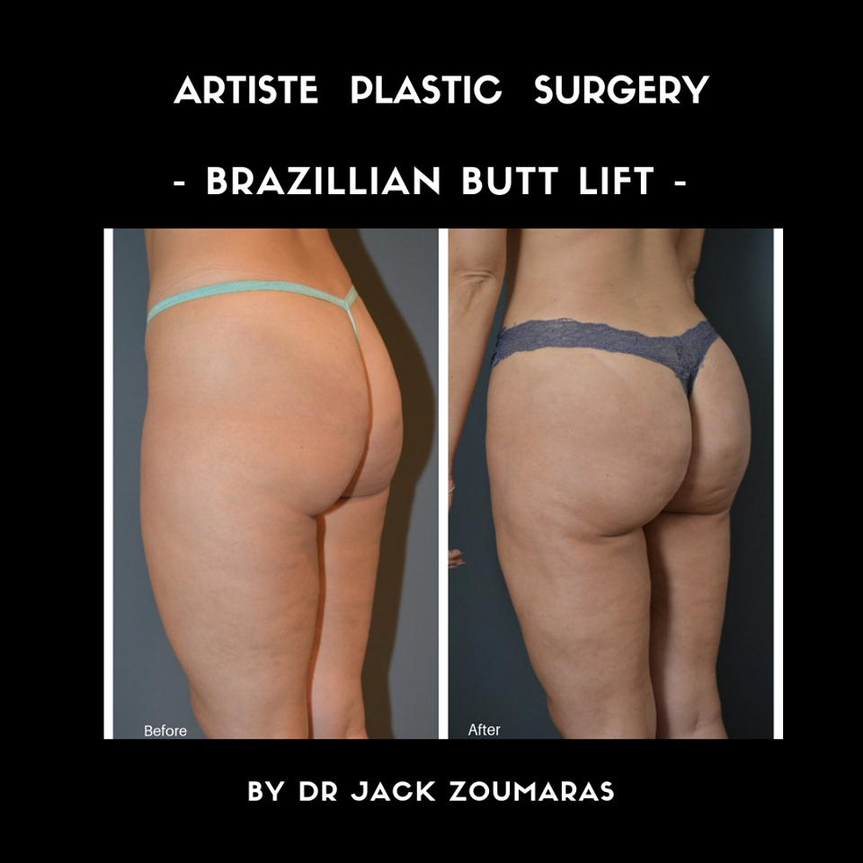 Images Artiste Plastic Surgery - Dr. Jack Zoumaras