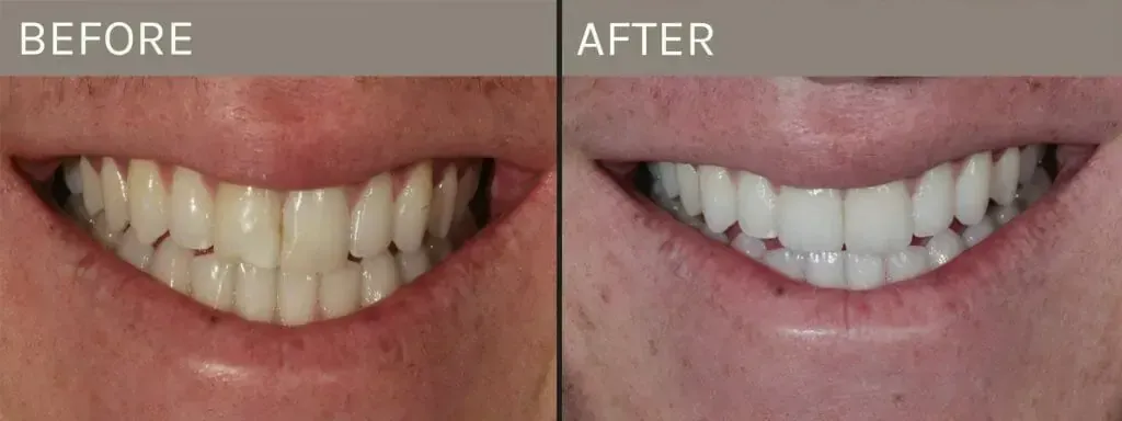 Garine & Boza Prosthodontics