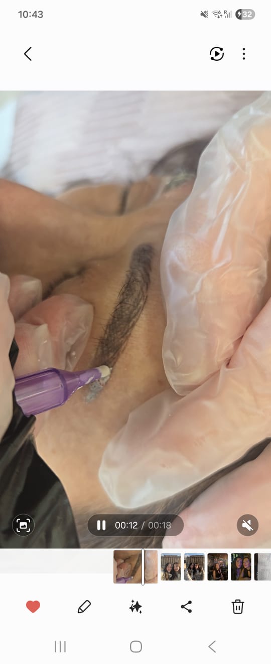 Détatouage Sourcils