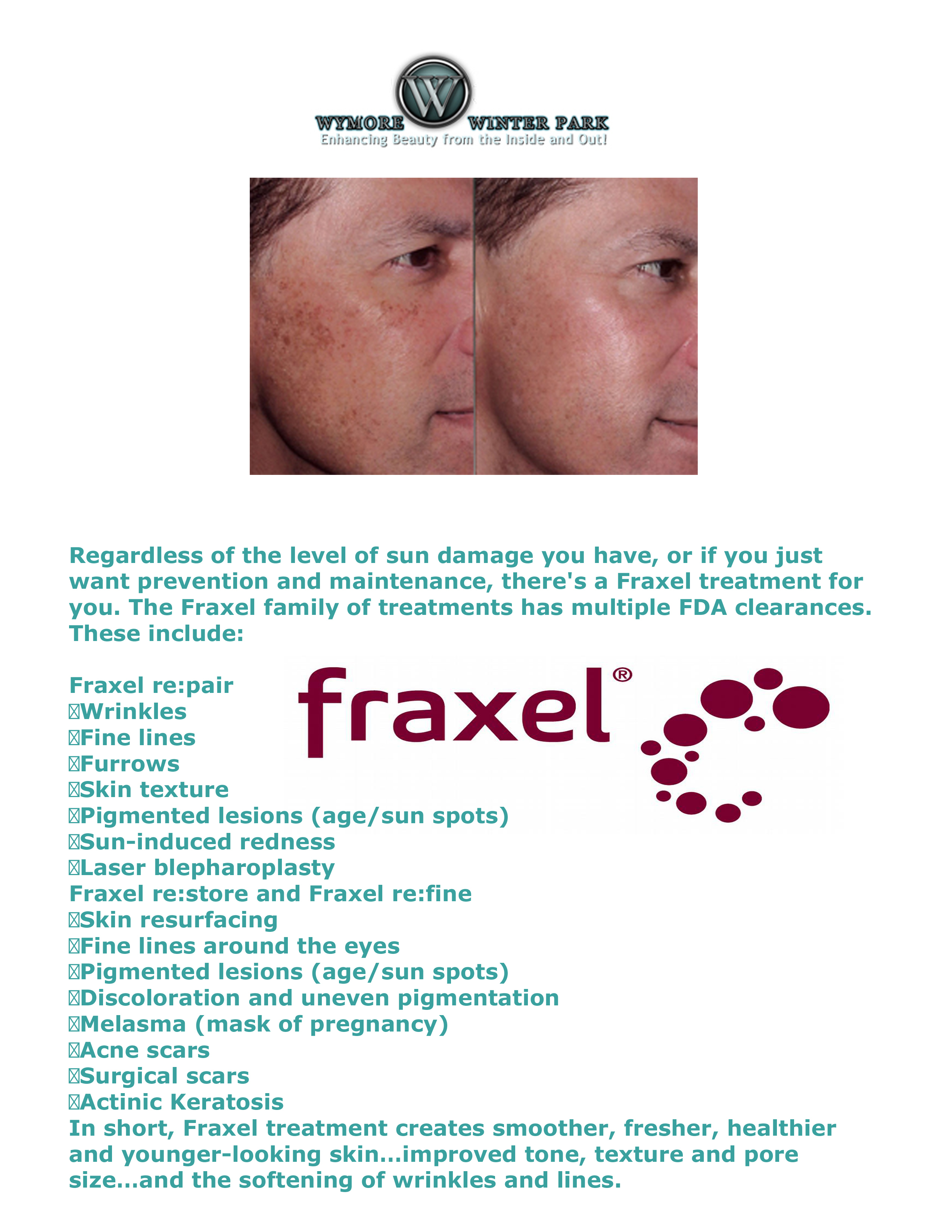 Fractional Resurfacing for Skin Tightening and Collagen 