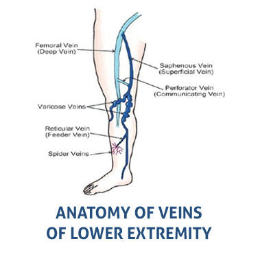 Images Vein Expert