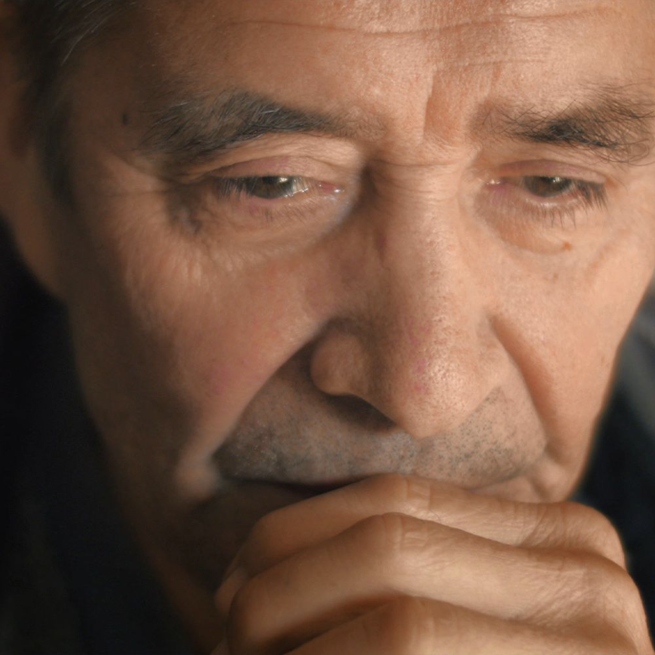 Macular Degeneration