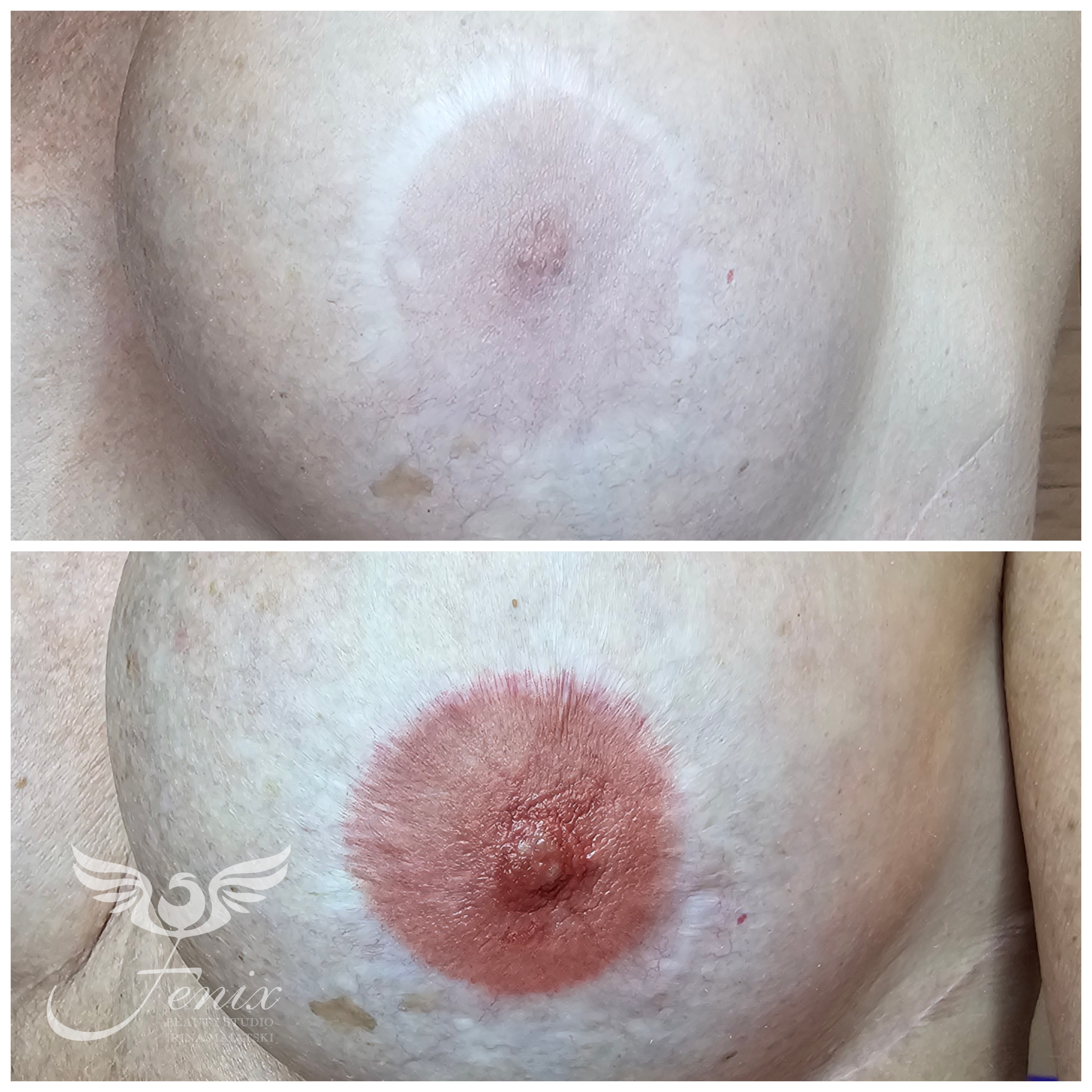 Medical Permanent Makeup