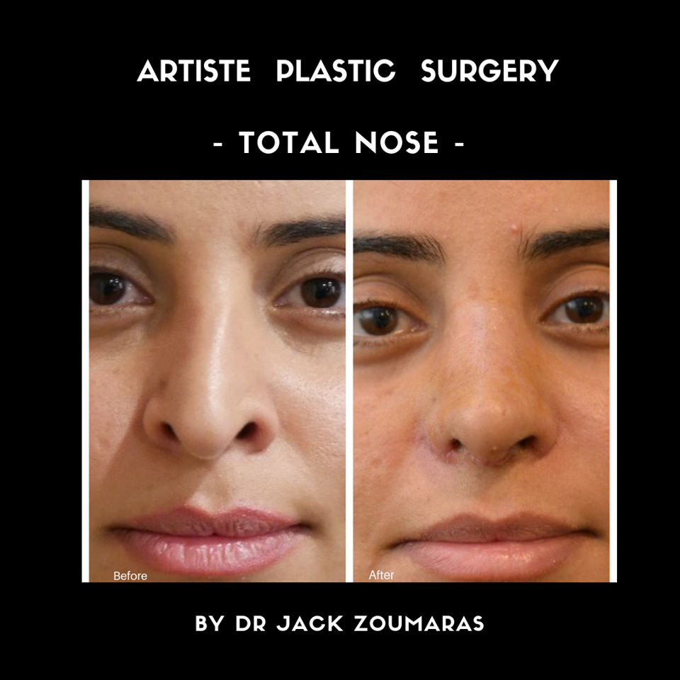 Images Artiste Plastic Surgery - Dr. Jack Zoumaras