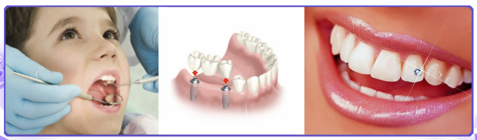 Images Clinica Dental Dentalvall