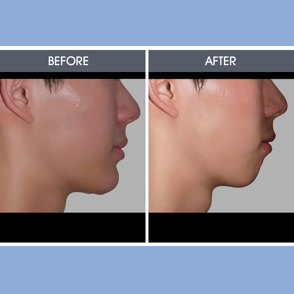 Images Darrick E. Antell, MD, FACS