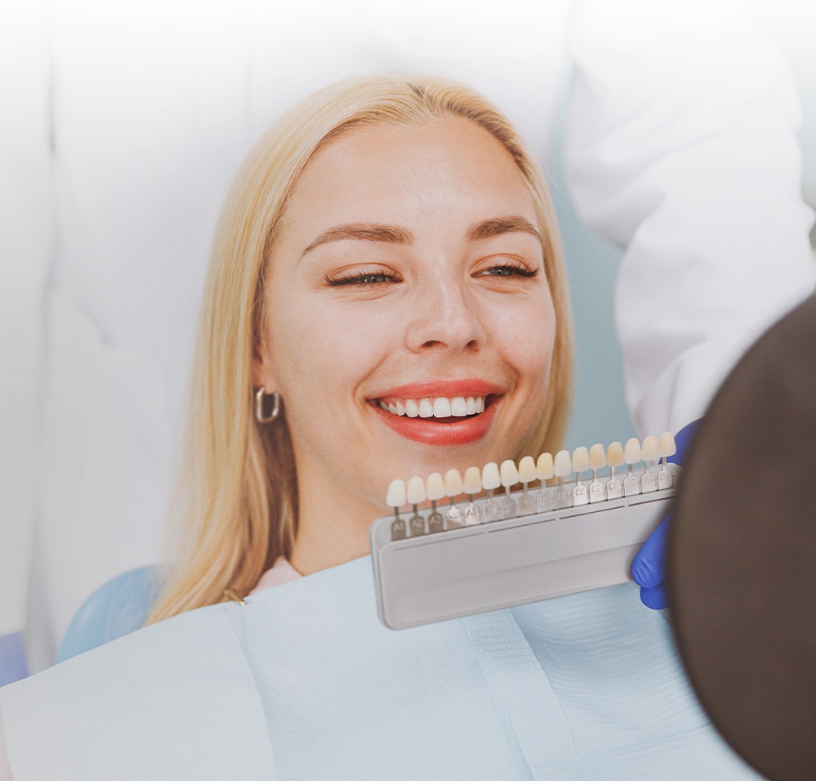 Veneers