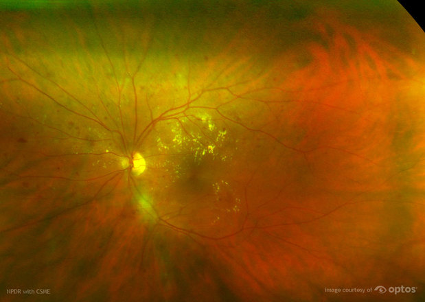Images Cascade Vision Center