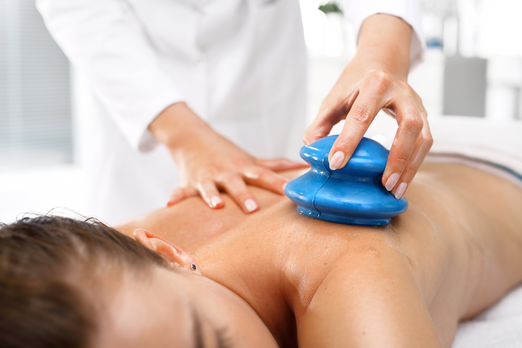 Cupping Therapy