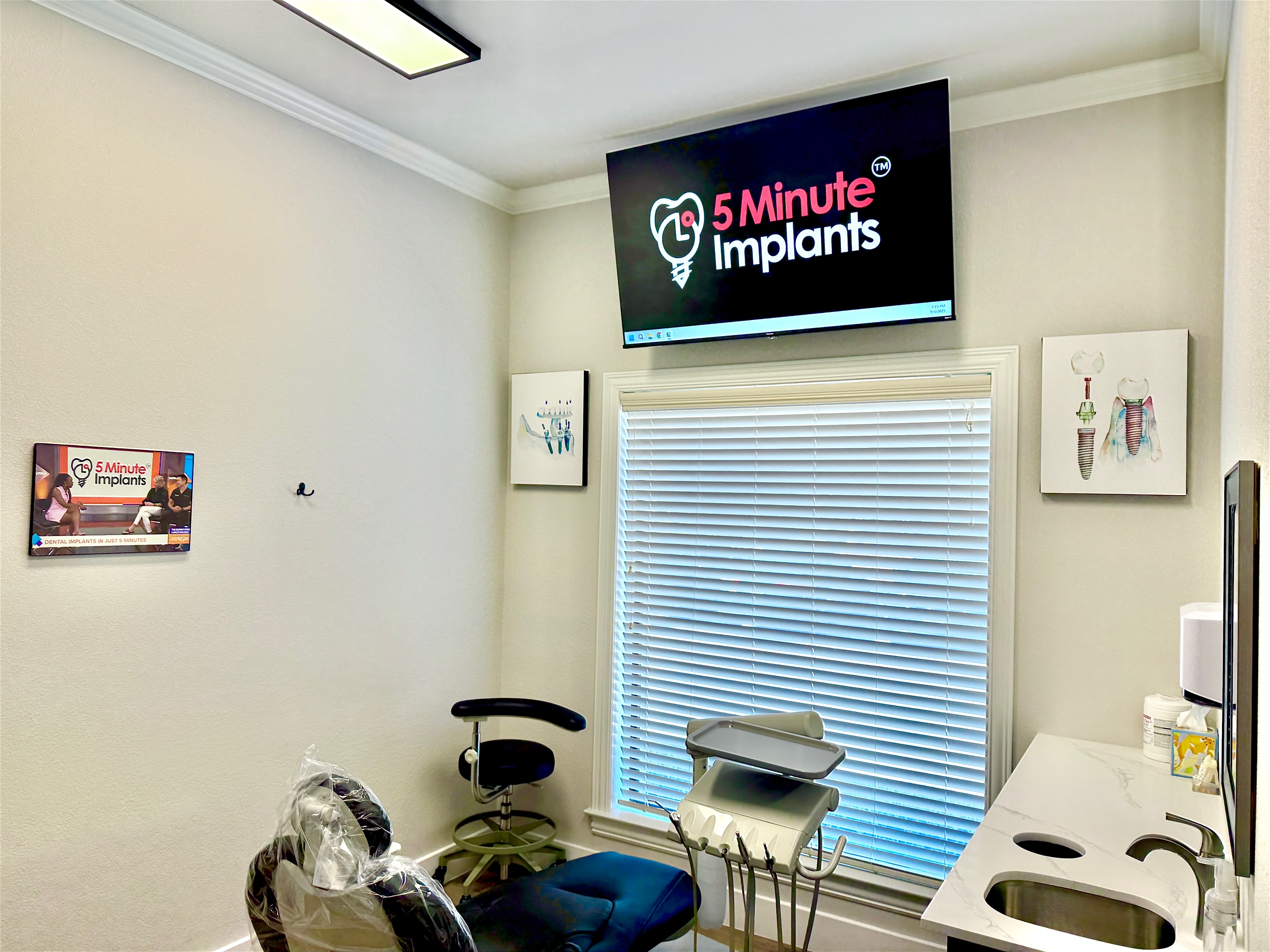 5 Minute Implants Image