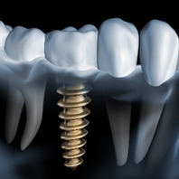 Images Gabinet Stomatologiczny Izodent-S
