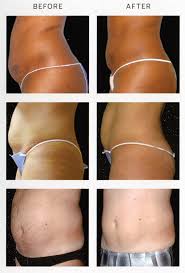 The Spa Boutique & Body Contouring of Trinity Photo