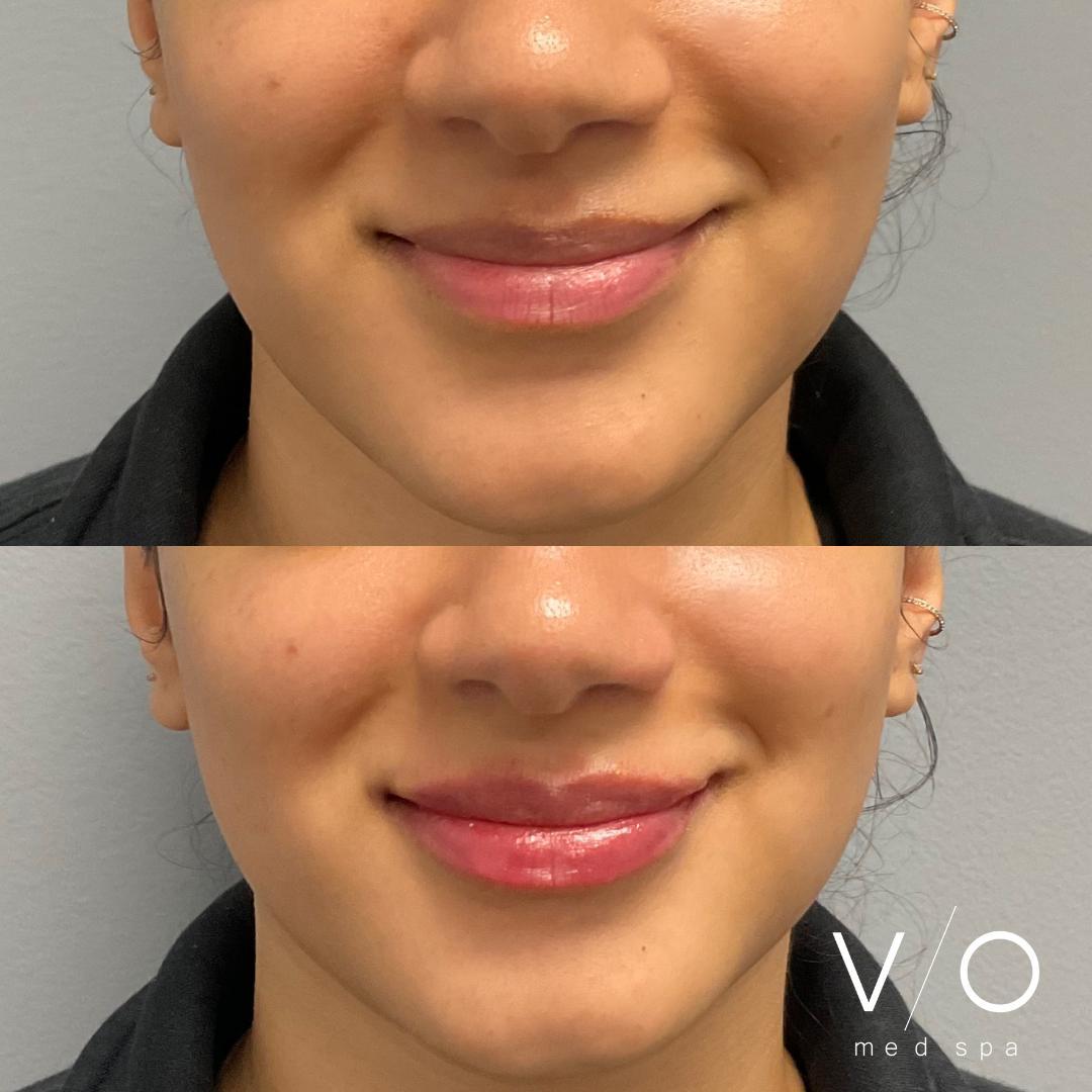 VIO Med Spa | Westwood
