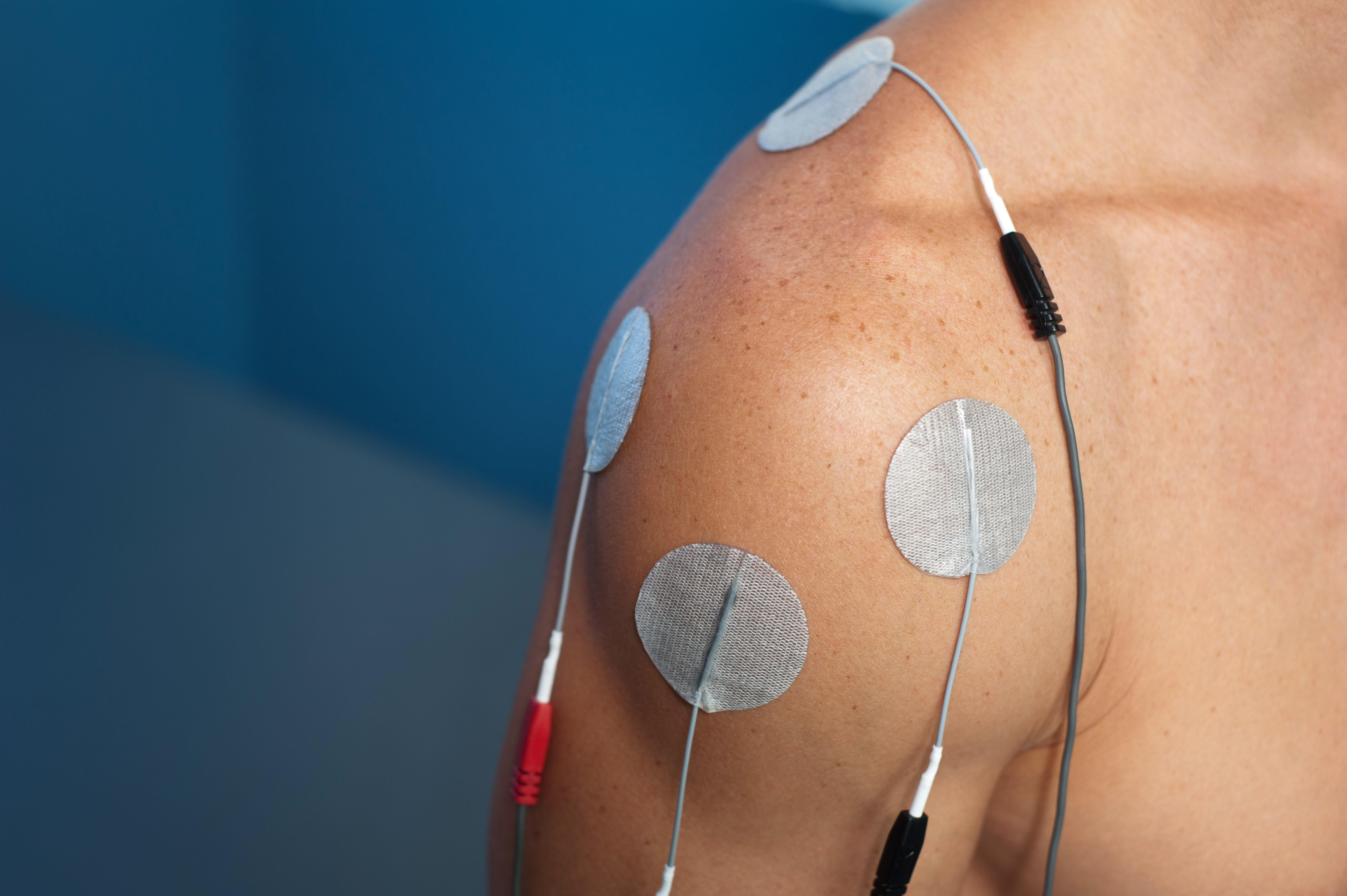 STIM Therapy