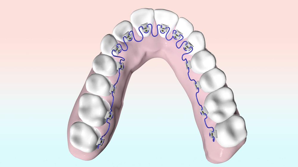 FitSmiles Orthodontics Photo