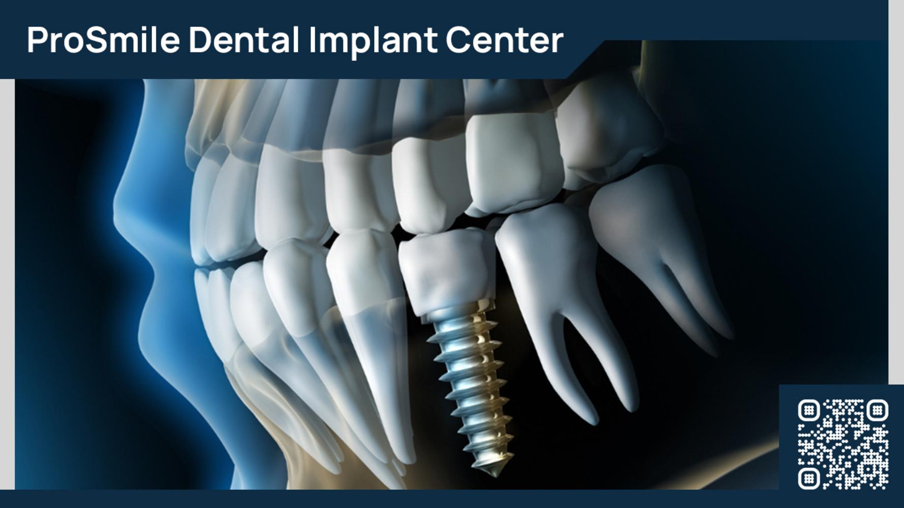 ProSmile Dental Implant Center