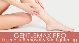 LASER HAIR REMOVAL