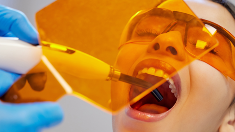 Fillings