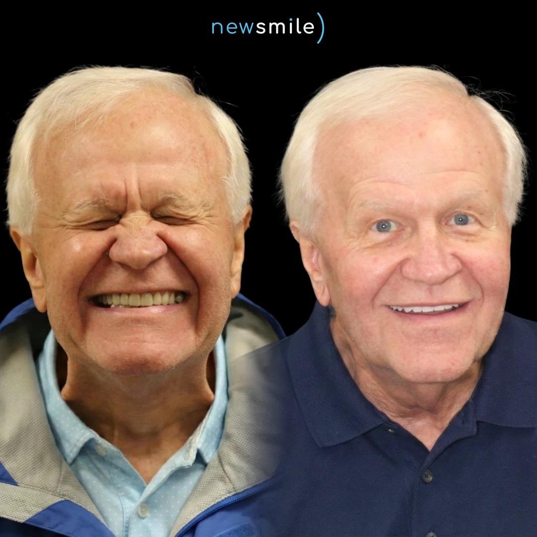 New Smile Columbus Dental Implant Studio Image