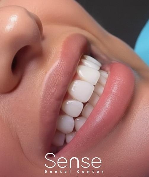 Sense Dental Center Image
