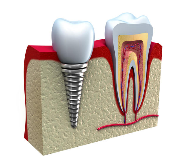 Images Rockville Dental Arts