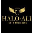 Halo Ali Teeth Whitening Photo