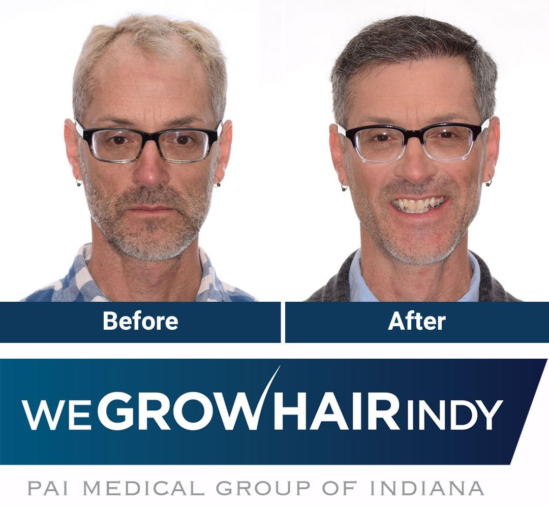 We Grow Hair Indy Photo