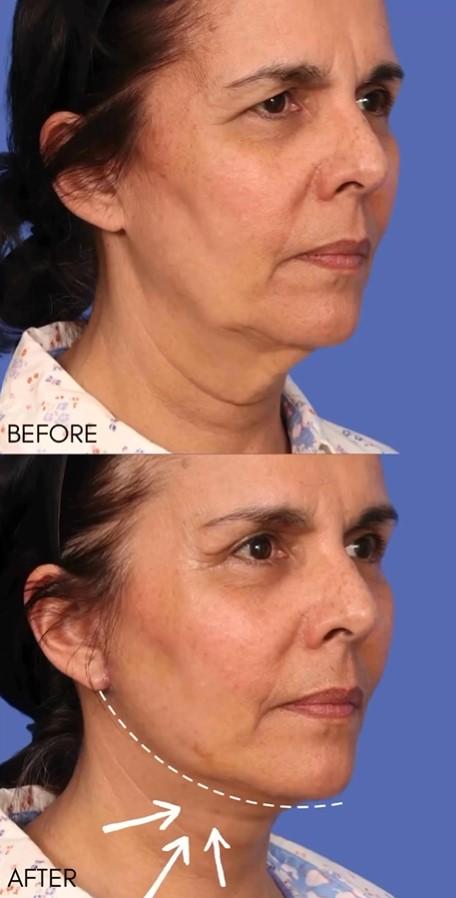 Cornerstone Plastic Surgery & Aesthetic Medicine