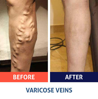 Images Vein Expert