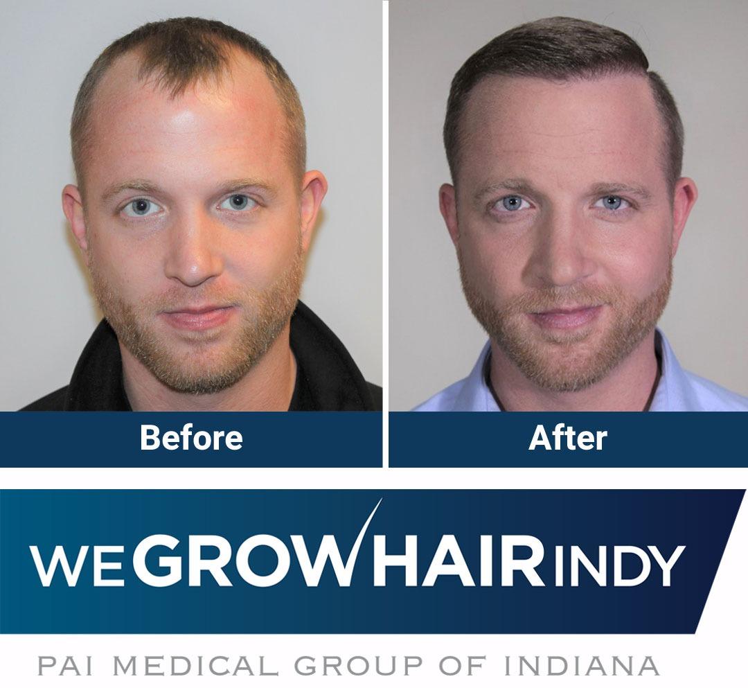 We Grow Hair Indy Photo