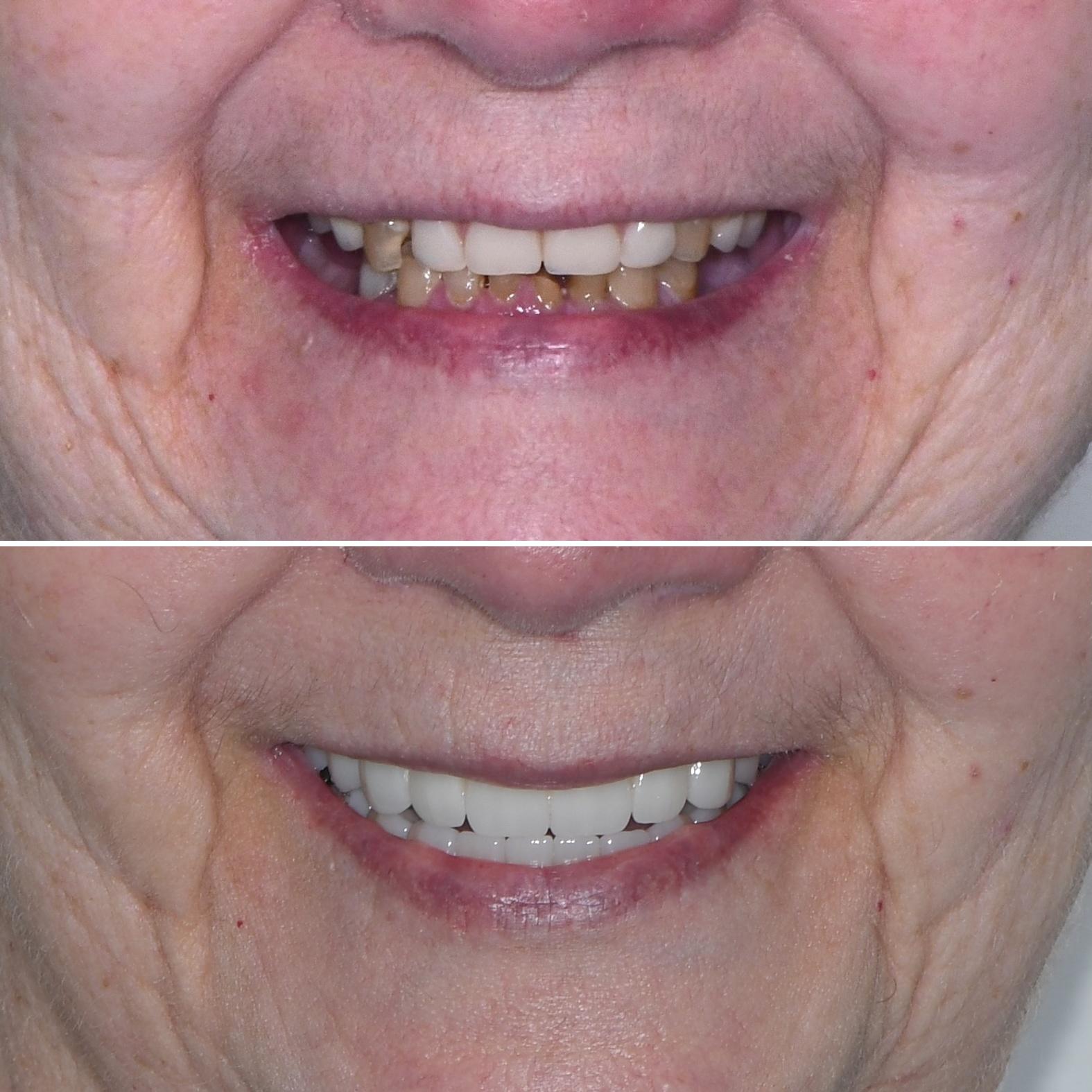 Empower Dental Pasadena Image