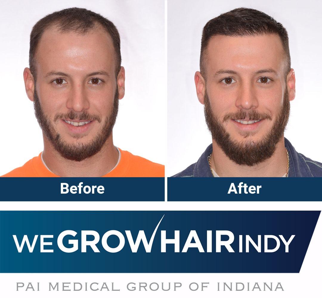 We Grow Hair Indy Photo