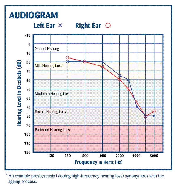 Comprehensive Audiogram