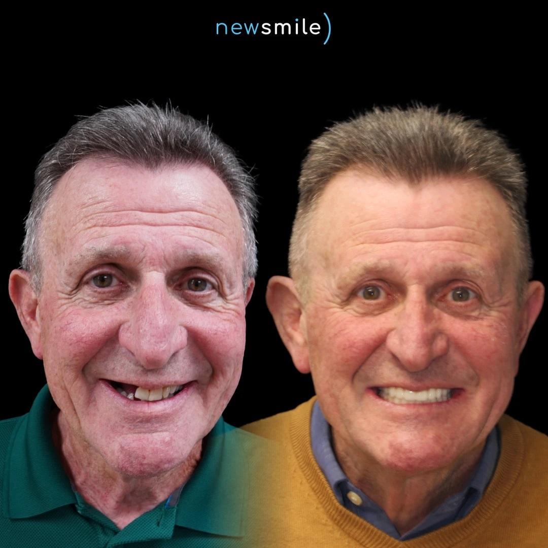New Smile Columbus Dental Implant Studio Image