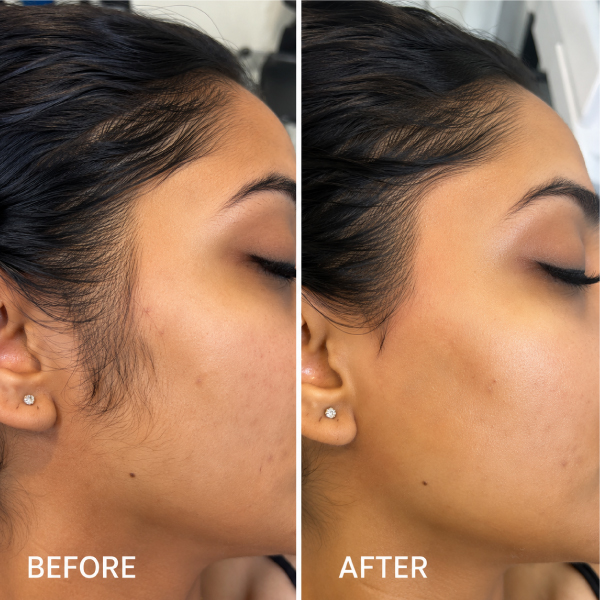 Full Face Waxing