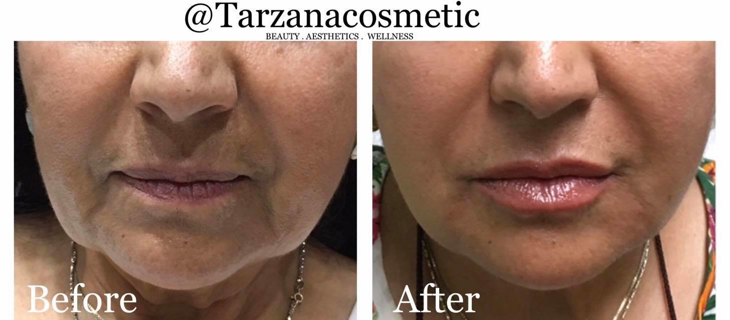 Tarzana Cosmetic Wellness & Medspa Photo