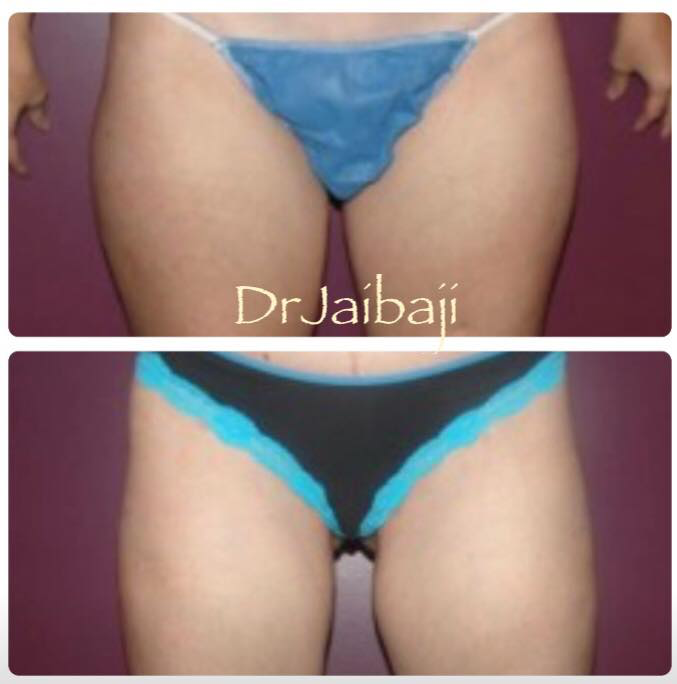 Jaibaji Plastic Surgery Photo