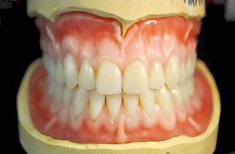 McCall Dentures Photo