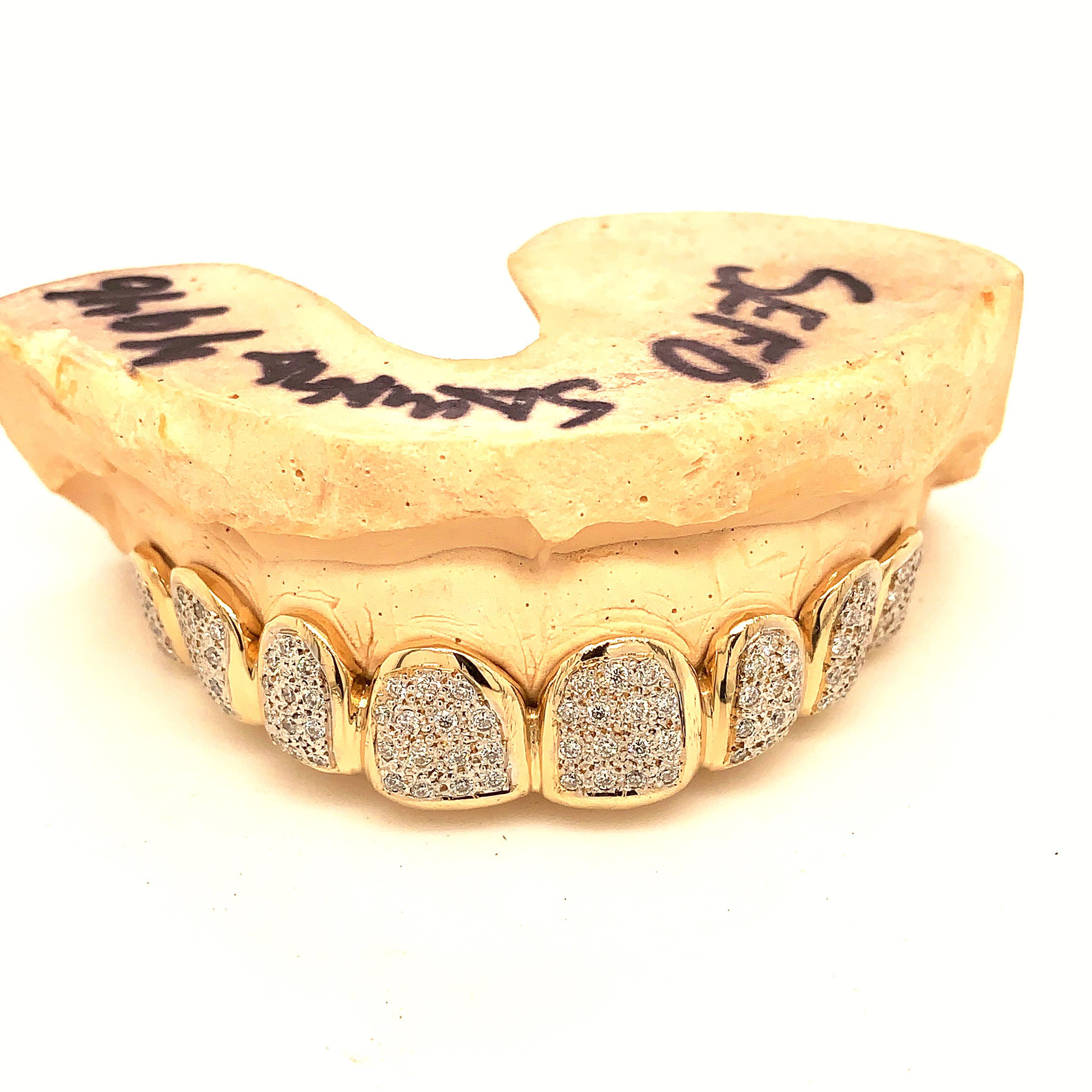 Seattle Gold Grills Photo