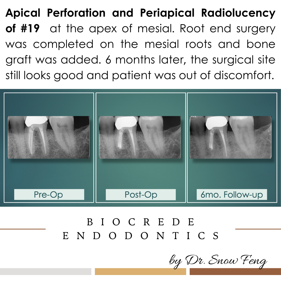 Biocrede Endodontics Image