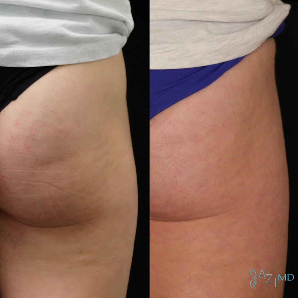 La Jolla Dermatology & Laser Surgery Center