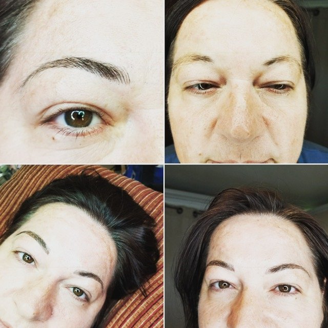 Images Brow Help