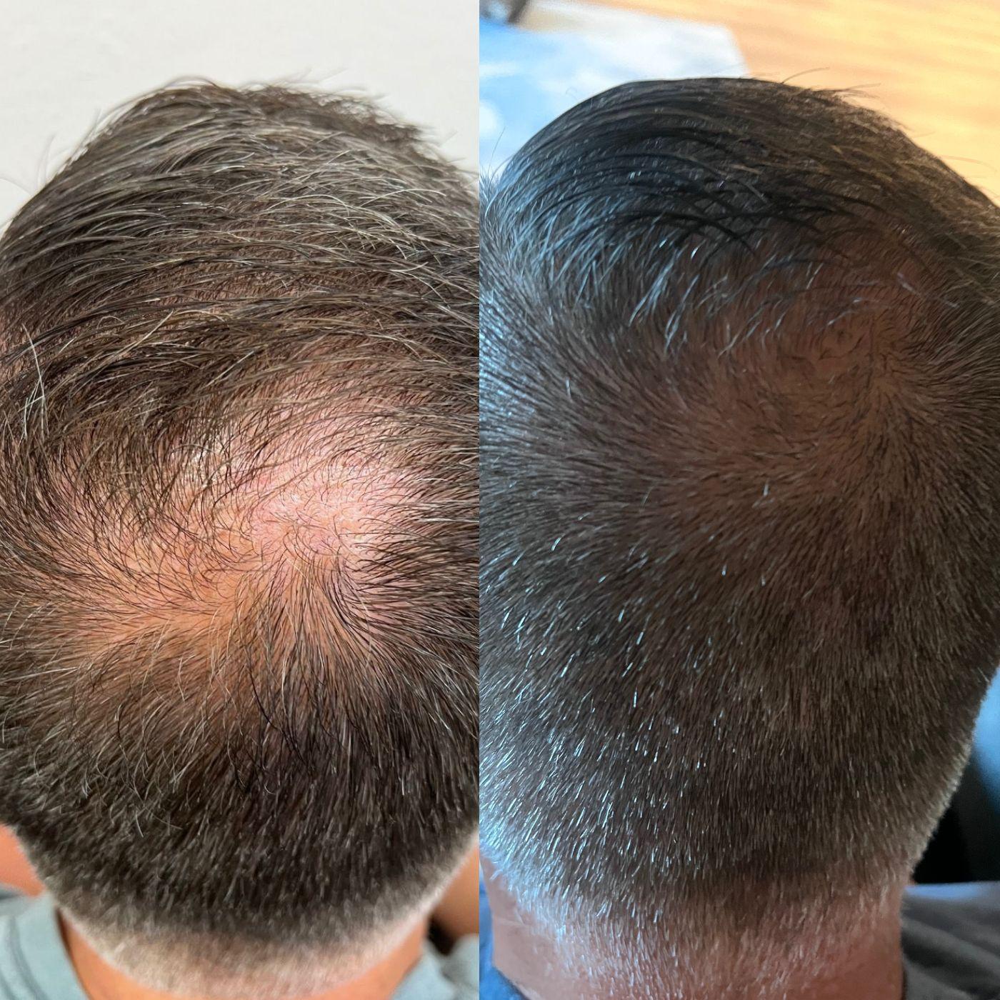 Injections and Co. Image