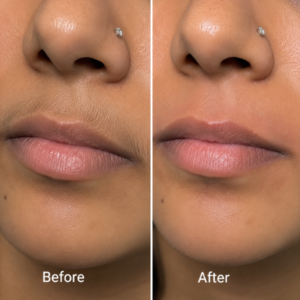 Upper Lip Waxing