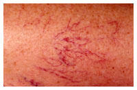 Florida Skin Cancer & Dermatology Specialists, Pa Photo