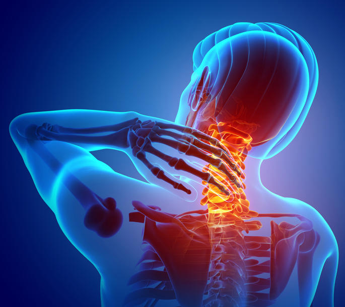 Cervical Radiculopathy Cervical Radiculopathy is a clinical condition in which the cervical nerve root is inflamed or damaged compressing the nerves from the spine. This is an irritation of the cervical nerve root that causes neurological dysfunction to various parts of the body depending on which nerve root is affected. Causes This condition can develop from a pinched nerve, degenerative bones, trauma, arthritis, a ruptured disc, bone spur, or any other anatomical or physiological changes that could potentially put pressure on the nerve roots. Symptoms A patient will experience chronic neck pain. They will also experience pain in the shoulders, arm, hands and upper back associated with weakness or numbness at the hands or fingers. An individual could also experience a loss of sensation. They may experience a lack of coordination and frequently drop items. Diagnosis If an individual continues to experience any of these signs or symptoms, they should be seen by a specialist to determine the reason for the pain. For additional information, you can contact California Sports & Rehab at (310) 652-6060 or visit our website at http://emg-ncv.com, (EMG/NCS). We can accommodate your needs in one of our convenient locations in the Los Angeles and Orange County areas.