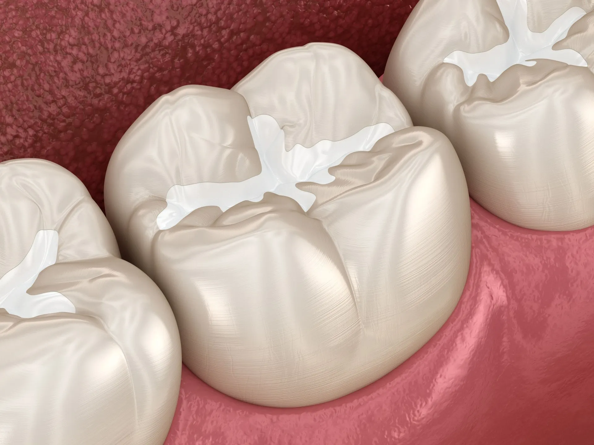 Dental Cleaning