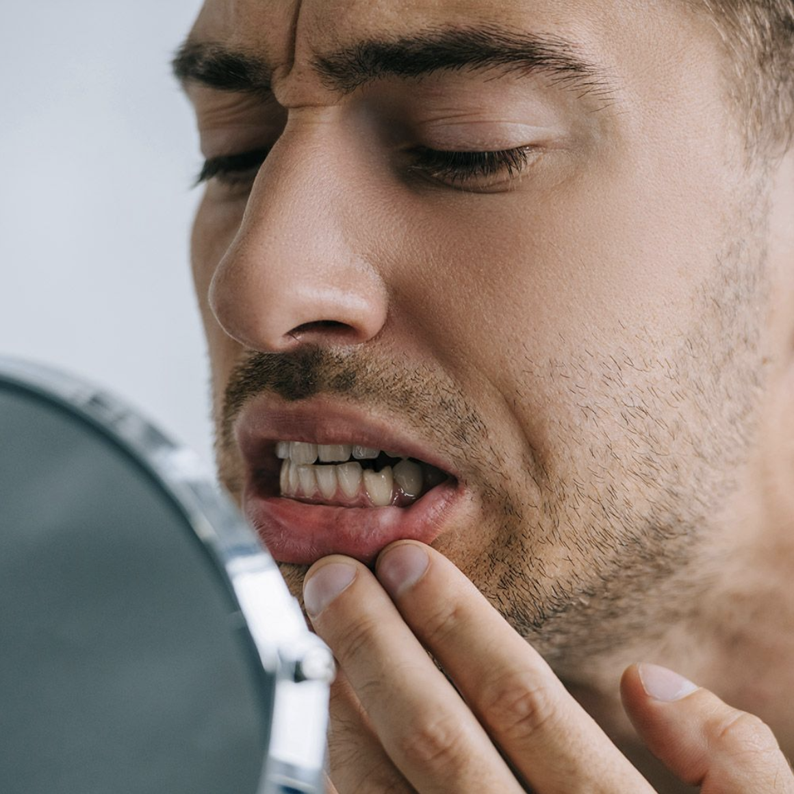Dental Crowns