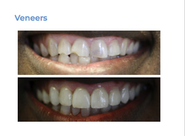 Uptown Cosmetic & Implant Dentistry Photo