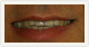 Darshan P. Patel, DDS, DPh, PLLC Esthetique Dental Photo